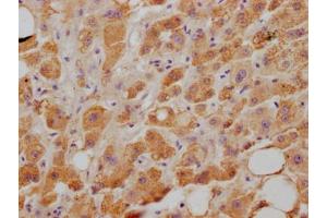 IHC image of ABIN7127645 diluted at 1:100 and staining in paraffin-embedded human liver tissue performed on a Leica BondTM system. (Rekombinanter NPC1L1 Antikörper)