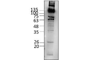 Western Blotting (WB) image for Mitogen-Activated Protein Kinase Kinase Kinase 14 (MAP3K14) (AA 1-947) protein (Strep Tag) (ABIN3093679)