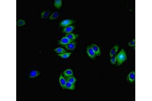 Immunofluorescent analysis of HepG2 cells using ABIN7173277 at dilution of 1:100 and Alexa Fluor 488-congugated AffiniPure Goat Anti-Rabbit IgG(H+L) (TMEM82 Antikörper  (AA 168-202))