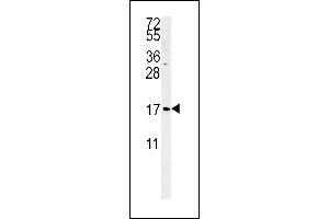 SGP Antibody (Center)&65288,Cat(ABIN651464 and ABIN2840255)&65289,western blot analysis in K562 cell line lysates (35 μg/lane). (SMAGP Antikörper  (AA 46-75))