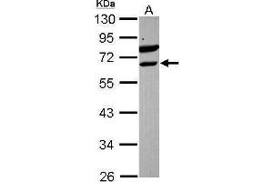 WB Image Sample (30 ug of whole cell lysate) A: Raji 10% SDS PAGE antibody diluted at 1:1000 (ETV6 Antikörper)