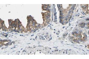 ABIN6272548 at 1/100 staining Human prostate tissue by IHC-P. (AK8 Antikörper  (Internal Region))