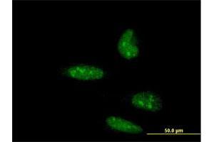 Immunofluorescence of monoclonal antibody to ATOH1 on HeLa cell. (ATOH1 Antikörper  (AA 266-354))