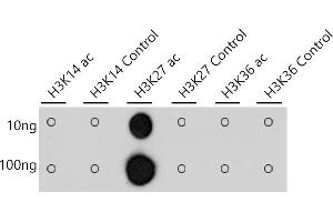 Dot-blot analysis of all sorts of peptides using Acetyl-Histone H3-K27 antibody (ABIN3016650, ABIN3016651, ABIN3016652, ABIN1682513 and ABIN1682514) at 1:1000 dilution. (Histone 3 Antikörper  (acLys27))