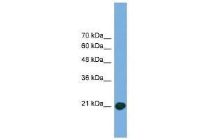 COMMD8 antibody used at 0. (COMMD8 Antikörper  (Middle Region))