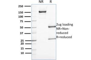 SDS-PAGE (SDS) image for anti-Annexin A1 (ANXA1) antibody (ABIN6939605)