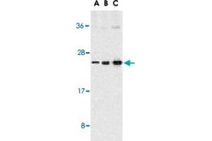 Western blot analysis of TNFSF13 expression in Jurkat cells with TNFSF13 polyclonal antibody  at 1 ug/mL (A), 2 ug/mL (B), and 4 ug/mL (C). (TNFSF13 Antikörper  (C-Term))