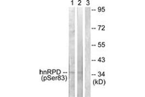 Western blot analysis of extracts from HuvEc and 293 cells, using hnRPD (Phospho-Ser83) Antibody. (HNRNPD/AUF1 Antikörper  (pSer83))