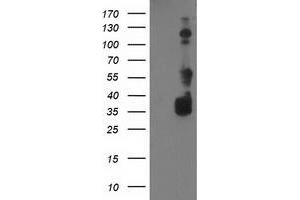 Western Blotting (WB) image for anti-BAI1-Associated Protein 2 (BAIAP2) antibody (ABIN1496805)