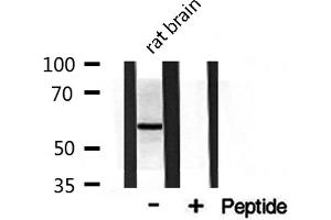 Western blot analysis on rat brain lysate using DOK3 Antibody (DOK3 Antikörper  (Internal Region))