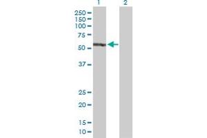 Western Blot analysis of EPB41 expression in transfected 293T cell line by EPB41 MaxPab polyclonal antibody. (EPB41 Antikörper  (AA 1-720))
