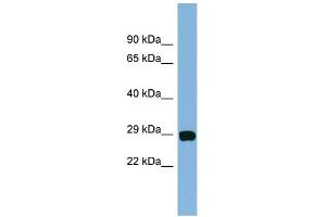 WB Suggested Anti-CHCHD3 Antibody Titration: 0. (CHCHD3 Antikörper  (N-Term))