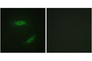 Immunofluorescence analysis of HepG2 cells, using CD4 (Phospho-Ser433) Antibody. (CD4 Antikörper  (pSer433))