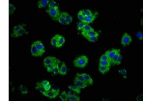 Immunofluorescence staining of HepG2 cells with ABIN7146190 at 1:100, counter-stained with DAPI. (E-cadherin Antikörper  (AA 153-641))