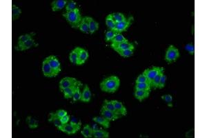 Immunofluorescence (IF) image for anti-Cadherin 1, Type 1, E-Cadherin (Epithelial) (CDH1) (AA 153-641) antibody (ABIN7146190)