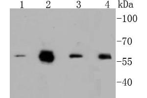 Lane 1: A549, Lane 2: HCT116, Lane 3: Hela, Lane 4: HepG2 cell lysates, probed with c-Myc(S62) (1A7 ) Monoclonal Antibody  at 1:1000 overnight at 4˚C. (c-MYC Antikörper  (pSer62))