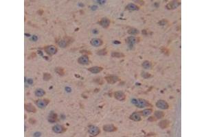 Immunohistochemistry (Paraffin-embedded Sections) (IHC (p)) image for anti-BCL2-Like 2 (BCL2L2) (AA 22-189) antibody (ABIN2909183)