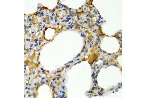 Immunohistochemistry of paraffin-embedded rat lung using IL9 antibody. (IL-9 Antikörper)