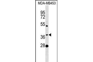 MTHFSD Antibody (N-term) (ABIN1539370 and ABIN2849273) western blot analysis in MDA-M cell line lysates (35 μg/lane). (MTHFSD Antikörper  (N-Term))