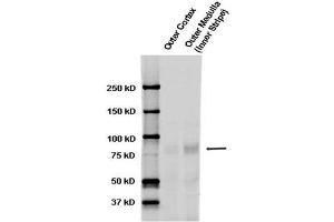 Western blot analysis of Rat kidney tissue lysates showing detection of ENaC protein using Rabbit Anti-ENaC Polyclonal Antibody . (SCNN1A Antikörper  (AA 46-68) (HRP))