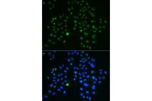 Immunofluorescence analysis of MCF7 cells using GNL3 antibody (ABIN6130343, ABIN6141249, ABIN6141250 and ABIN6222113). (Nucleostemin Antikörper  (AA 1-240))