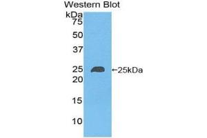 Western Blotting (WB) image for anti-NME/NM23 Nucleoside Diphosphate Kinase 6 (NME6) (AA 3-182) antibody (ABIN1860011) (NME6 Antikörper  (AA 3-182))