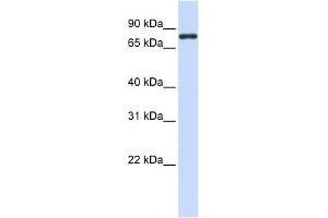 ACP6 antibody used at 1 ug/ml to detect target protein. (ACP6 Antikörper  (N-Term))