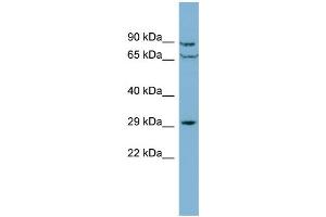 WB Suggested Anti-CUTC  Antibody Titration: 0. (CUTC Antikörper  (Middle Region))