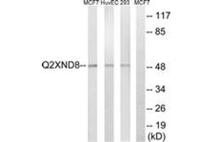 Western blot analysis of extracts from 293/HuvEc/MCF-7 cells, using Cytochrome P450 2D6 Antibody. (CYP2D6 Antikörper  (AA 41-90))