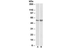 Western blot testing of A431 [A] and Jurkat lysate [B] with FYN antibody at 0. (FYN Antikörper)