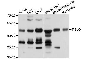 Western blot analysis of extracts of various cells, using PELO antibody. (PELO Antikörper)