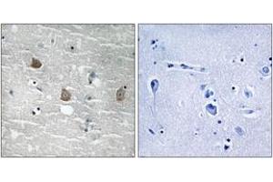 Immunohistochemistry analysis of paraffin-embedded human brain, using TOB1 (Phospho-Ser164) Antibody. (Protein Tob1 (TOB1) (AA 130-179), (pSer164) Antikörper)