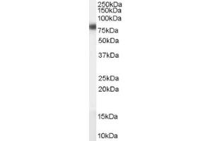Image no. 1 for anti-Carnitine Palmitoyltransferase 1A (Liver) (CPT1A) (Internal Region) antibody (ABIN374737) (CPT1A Antikörper  (Internal Region))