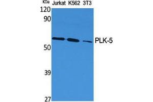 Western Blot (WB) analysis of specific cells using PLK-5 Polyclonal Antibody. (PLK5 Antikörper  (Internal Region))