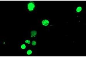 Image no. 3 for anti-T-Cell Acute Lymphocytic Leukemia 1 (TAL1) antibody (ABIN1501295) (TAL1 Antikörper)