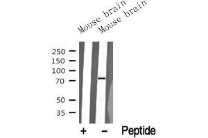 Western blot analysis of extracts of Mouse brain tissue sample,using NuaK1 Antibody(ABIN6272814).
