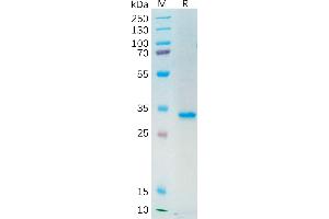 Secreted Frizzled-Related Protein 2 (SFRP2) (AA 25-295) protein (His tag)
