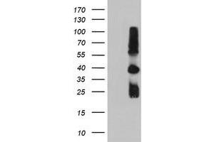 Western Blotting (WB) image for anti-Metalloproteinase Inhibitor 2 (TIMP2) antibody (ABIN1501393)
