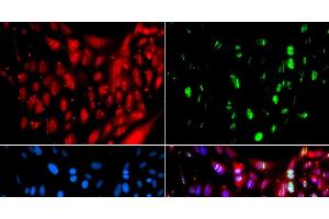 Immunofluorescence analysis of GFP-RNF168 transgenic U2OS cells using UIMC1 Polyclonal Antibody (UIMC1 Antikörper)