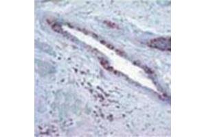 Image no. 2 for anti-Retinoblastoma Protein (Rb Protein) (Cleavage Site) antibody (ABIN207915) (Retinoblastoma Protein (Rb) Antikörper  (Cleavage Site))