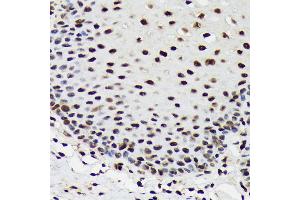 Immunohistochemistry of paraffin-embedded human esophageal using SF3B3/S Rabbit mAb (ABIN7270544) at dilution of 1:100 (40x lens). (SF3B3 Antikörper)