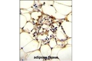 anti-Chromosome 11 Open Reading Frame 95 (C11orf95) (AA 556-584), (C-Term) antibody