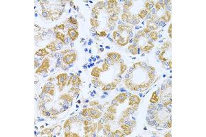 Immunohistochemistry of paraffin-embedded human stomach using IRS1 antibody (ABIN5970075) at dilution of 1/100 (40x lens). (IRS1 Antikörper)