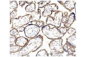 IHC analysis of Hexokinase 1/HK1 using anti-Hexokinase 1/HK1 antibody (ABIN7600258). (Hexokinase 1 Antikörper  (AA 17-323))