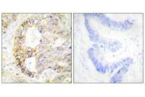 Immunohistochemistry analysis of paraffin-embedded human colon carcinoma tissue using COX41 antibody. (COX IV Antikörper  (N-Term))