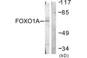 Western blot analysis of extracts from HeLa cells, treated with Serum 20% 15', using FOXO1A (Ab-329) Antibody. (FOXO1 Antikörper  (AA 295-344))