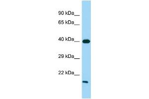 Host: Rabbit Target Name: GPR21 Sample Type: Fetal Heart lysates Antibody Dilution: 1. (GPR21 Antikörper  (C-Term))