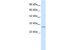 WB Suggested Anti-TBX20 Antibody Titration: 0. (TBX20 Antikörper  (N-Term))