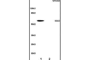 Lane 1: mouse liver lysates Lane 2: rat brain lysates probed with Anti OAT-1/SLC22A6 Polyclonal Antibody, Unconjugated (ABIN670791) at 1:200 overnight at 4 °C. (Slco1a1 Antikörper  (AA 2-90))