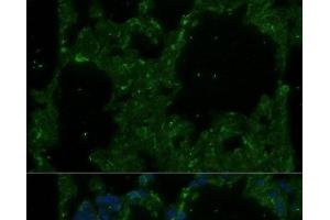 Immunofluorescence analysis of Rat lung using TREM2 Polyclonal Antibody at dilution of 1:100. (TREM2 Antikörper)